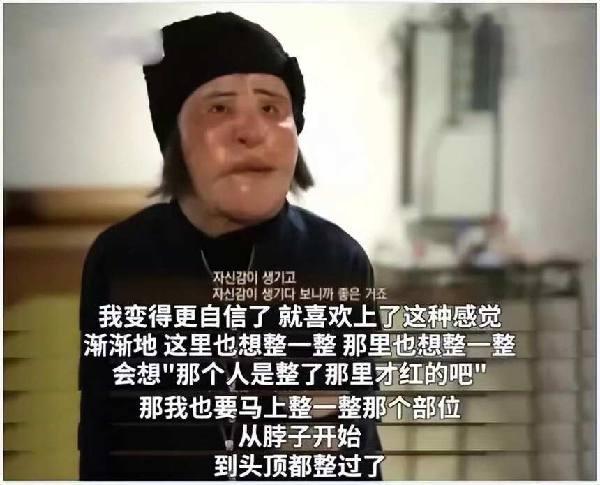 “整容上瘾”韩慧景：把脸整成电风扇，自行注射食用油，代价惨痛